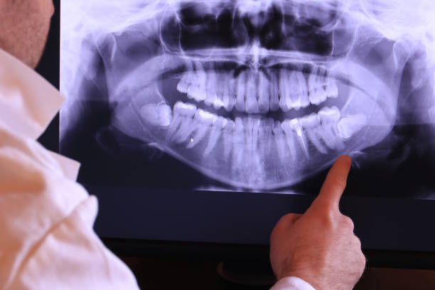 Best Dentist for Tooth Abscess  in Guttenberg, NJ